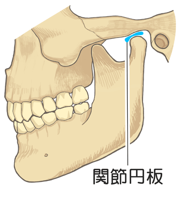 閉口時全体