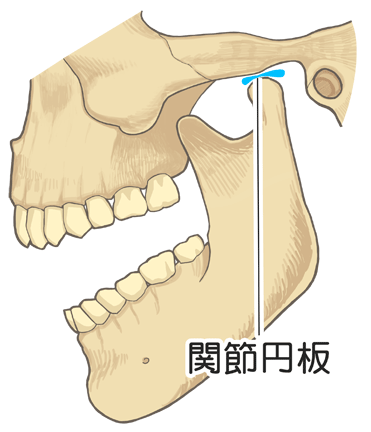 開口時全体